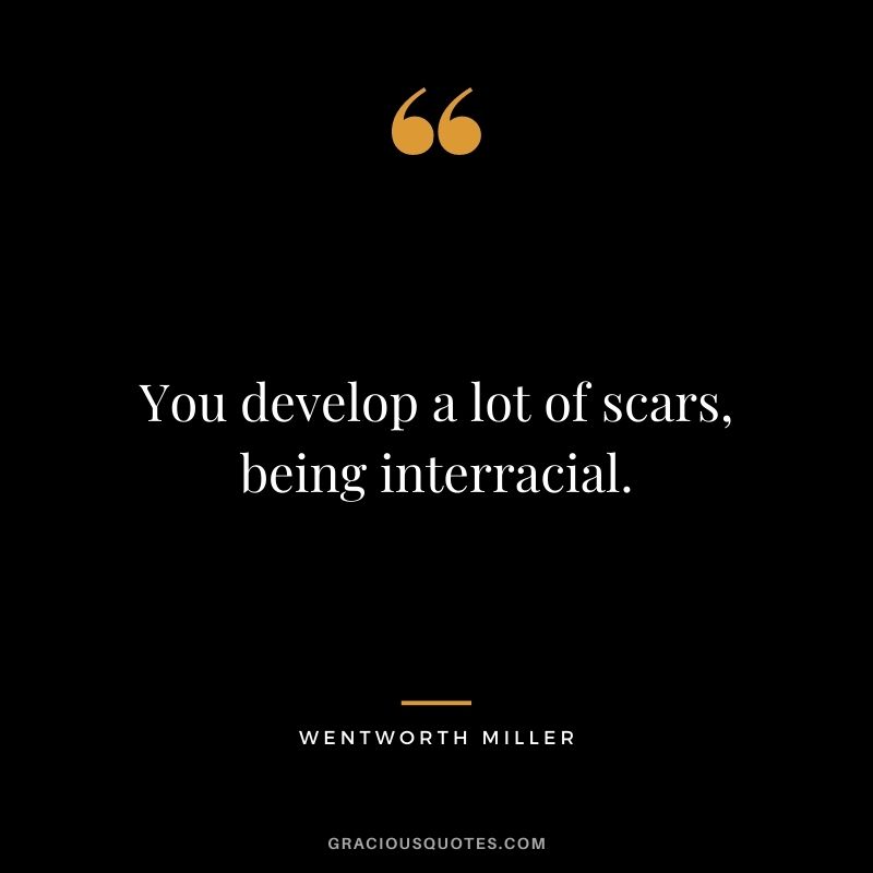 You develop a lot of scars, being interracial.