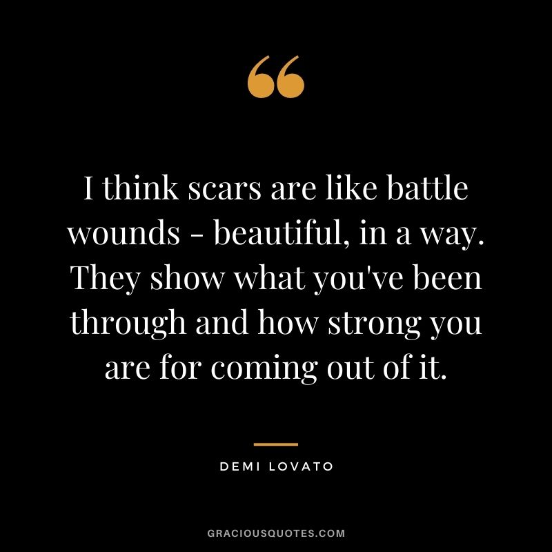 I think scars are like battle wounds - beautiful, in a way. They show what you've been through and how strong you are for coming out of it.